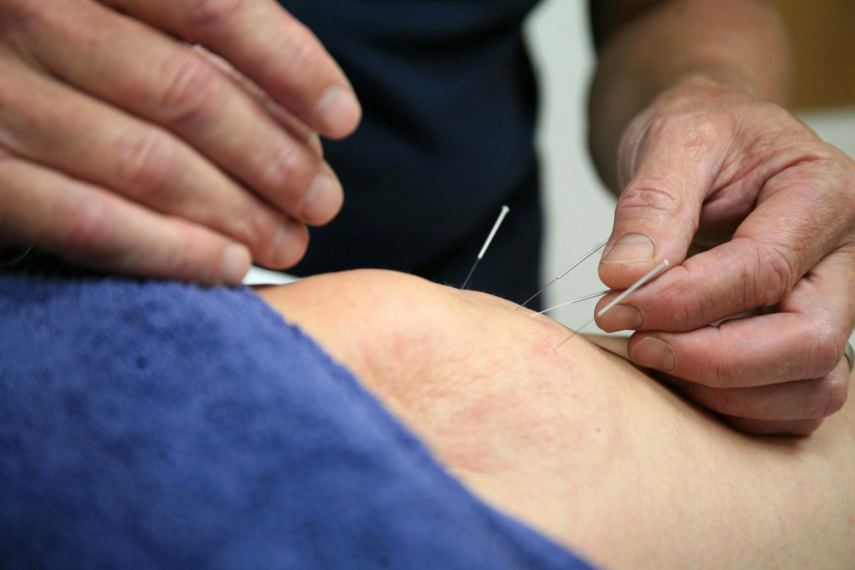 True Physio Congleton, Physiotherapy & Sports Massage clinic in Congleton (photo 10)
